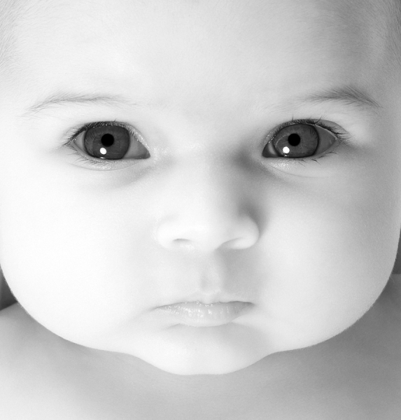Photograph Lennette Newell Baby Face on One Eyeland